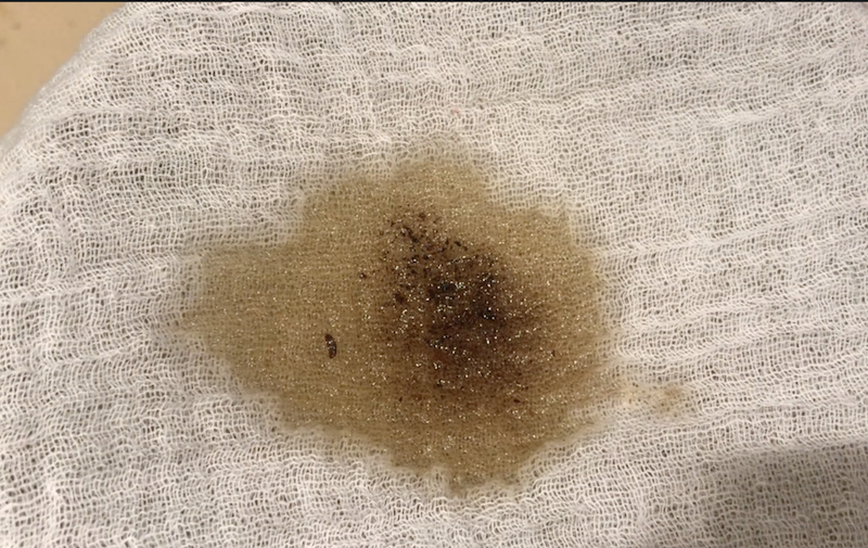 粗棉布会夹住褐色的肉块。 使用多层，并确保在浇注前猪油是热的。