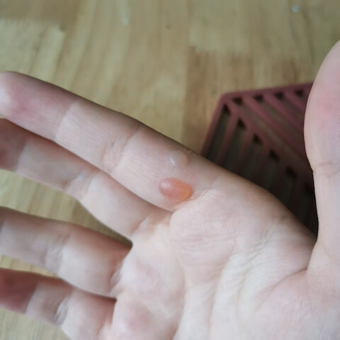 我的水泡变成了老茧。